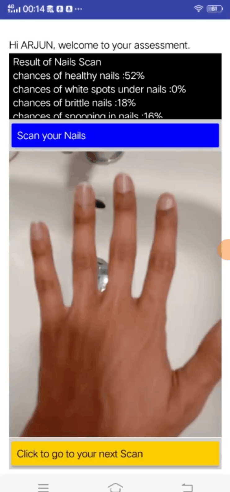 Pocket Doc nail scan and assessment screen