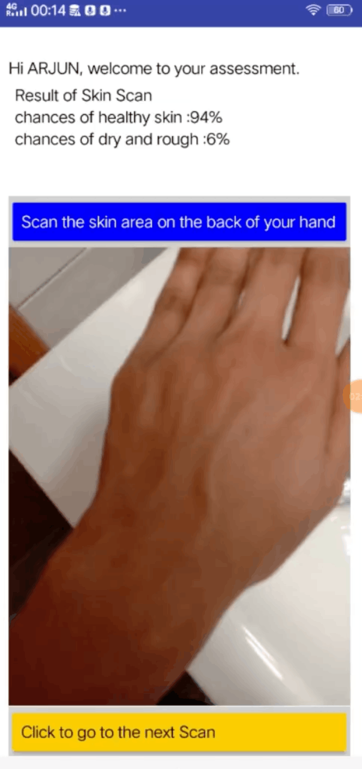 Pocket Doc skin scan and assessment screen