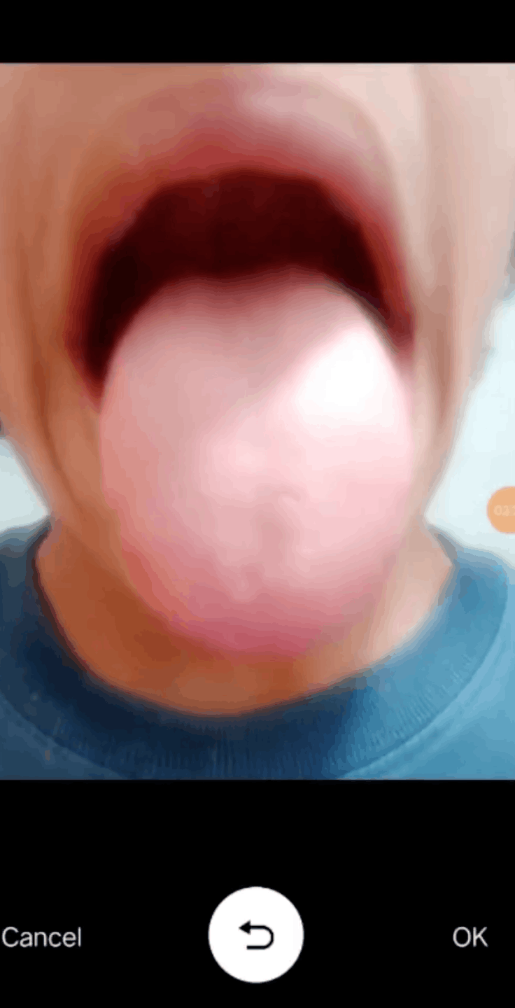 Pocket Doc tongue image capture screen